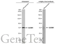 Anti-SARM1 antibody [HL1066] used in Western Blot (WB). GTX636097