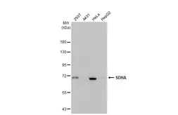 Anti-SDHA antibody [HL1067] used in Western Blot (WB). GTX636098