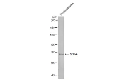 Anti-SDHA antibody [HL1067] used in Western Blot (WB). GTX636098