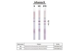 Anti-Influenza B virus Nucleoprotein antibody [HL1068] used in Lateral Flow (Lateral Flow). GTX636099