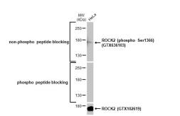 Anti-ROCK2 (phospho Ser1366) antibody [HL1071] used in Western Blot (WB). GTX636103