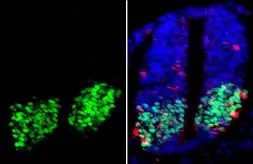 Anti-OLIG2 antibody [HL1072] used in IHC (Paraffin sections) (IHC-P). GTX636104