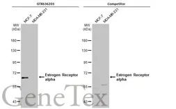 Anti-Estrogen Receptor alpha antibody [HL1082] used in Western Blot (WB). GTX636203