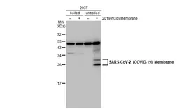 Anti-SARS-CoV-2 (COVID-19) Membrane antibody [HL1088] used in Western Blot (WB). GTX636246
