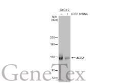Anti-ACE2 antibody [HL1092] used in Western Blot (WB). GTX636265