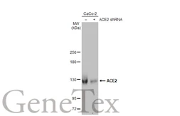 Anti-ACE2 antibody [HL1092] used in Western Blot (WB). GTX636265