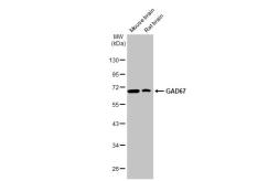 Anti-GAD67 antibody [HL1095] used in Western Blot (WB). GTX636279