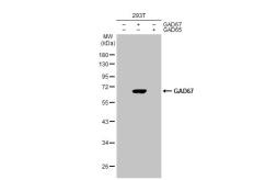 Anti-GAD67 antibody [HL1095] used in Western Blot (WB). GTX636279