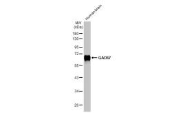 Anti-GAD67 antibody [HL1096] used in Western Blot (WB). GTX636280