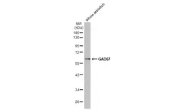 Anti-GAD67 antibody [HL1096] used in Western Blot (WB). GTX636280