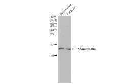 Anti-Somatostatin antibody [HL1101] used in Western Blot (WB). GTX636297