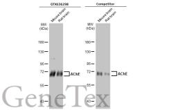 Anti-AChE antibody [HL1102] used in Western Blot (WB). GTX636298