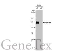 Anti-DDR2 antibody [HL1107] used in Western Blot (WB). GTX636322