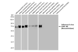Anti-Influenza A virus H1N1 NA (Neuraminidase) antibody [HL1108] used in Western Blot (WB). GTX636323