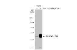 Anti-SQSTM1 / P62 antibody [HL1113] used in Western Blot (WB). GTX636328