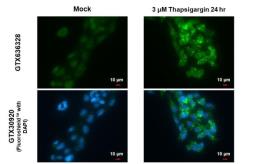 Anti-SQSTM1 / P62 antibody [HL1113] used in Immunocytochemistry/ Immunofluorescence (ICC/IF). GTX636328