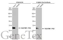Anti-SQSTM1 / P62 antibody [HL1113] used in Western Blot (WB). GTX636328