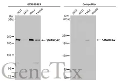 Anti-SMARCA2 antibody [HL1114] used in Western Blot (WB). GTX636329