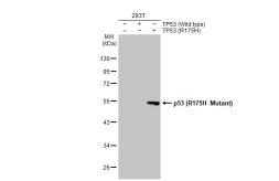 Anti-p53 (R175H Mutant) antibody [HL1129] used in Western Blot (WB). GTX636395