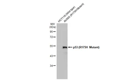 Anti-p53 (R175H Mutant) antibody [HL1129] used in Western Blot (WB). GTX636395