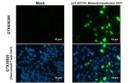 Anti-p53 (R175H Mutant) antibody [HL1129] used in Immunocytochemistry/ Immunofluorescence (ICC/IF). GTX636395