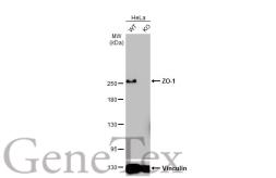 Anti-ZO-1 antibody [HL1133] used in Western Blot (WB). GTX636399
