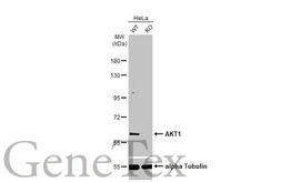 Anti-AKT1 antibody [HL1142] used in Western Blot (WB). GTX636413