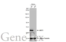 Anti-AKT1 antibody [HL1145] used in Western Blot (WB). GTX636416