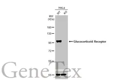 Anti-Glucocorticoid Receptor antibody [HL1149] used in Western Blot (WB). GTX636420