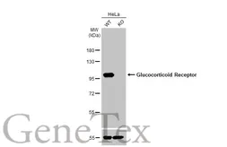 Anti-Glucocorticoid Receptor antibody [HL1151] used in Western Blot (WB). GTX636422