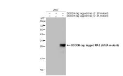 Anti-RAS (G12A mutant) antibody [HL1153] used in Western Blot (WB). GTX636434