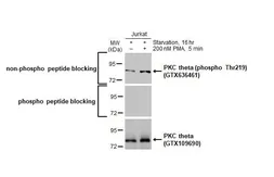 Anti-PKC theta (phospho Thr219) antibody [HL1157] used in Western Blot (WB). GTX636461