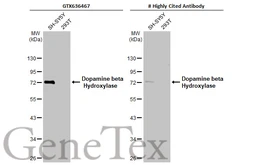 Anti-Dopamine beta Hydroxylase antibody [HL1163] used in Western Blot (WB). GTX636467