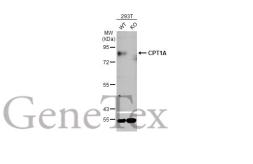 Anti-CPT1A antibody [HL1164] used in Western Blot (WB). GTX636468