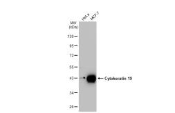 Anti-Cytokeratin 19 antibody [HL1165] used in Western Blot (WB). GTX636469