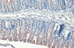 Anti-Cytokeratin 19 antibody [HL1165] used in IHC (Paraffin sections) (IHC-P). GTX636469