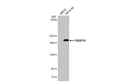 Anti-PARP14 antibody [HL1178] used in Western Blot (WB). GTX636483