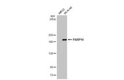 Anti-PARP14 antibody [HL1180] used in Western Blot (WB). GTX636485