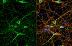 Anti-GAD65 + GAD67 antibody [HL1181] used in Immunocytochemistry/ Immunofluorescence (ICC/IF). GTX636487