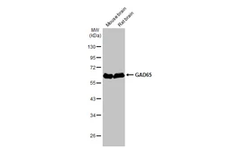 Anti-GAD65 antibody [HL1187] used in Western Blot (WB). GTX636493