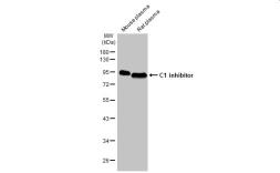 Anti-C1 inhibitor antibody [HL1196] used in Western Blot (WB). GTX636508