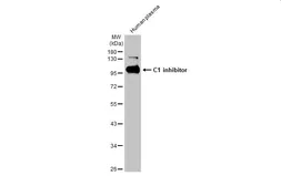 Anti-C1 inhibitor antibody [HL1196] used in Western Blot (WB). GTX636508