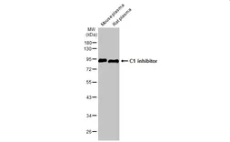 Anti-C1 inhibitor antibody [HL1197] used in Western Blot (WB). GTX636509