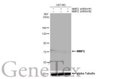 Anti-MMP2 antibody [HL1207] used in Western Blot (WB). GTX636524