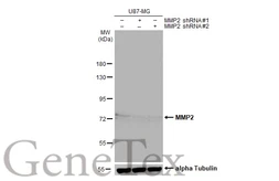 Anti-MMP2 antibody [HL1207] used in Western Blot (WB). GTX636524