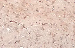 Anti-Nucleoporin p62 antibody [HL1226] used in IHC (Paraffin sections) (IHC-P). GTX636570