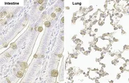 Anti-Nucleoporin p62 antibody [HL1226] used in IHC (Paraffin sections) (IHC-P). GTX636570