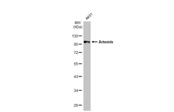 Anti-Artemis antibody [HL1227] used in Western Blot (WB). GTX636575