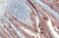 Anti-E-Cadherin antibody [HL1228] used in IHC (Paraffin sections) (IHC-P). GTX636576