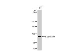 Anti-E-Cadherin antibody [HL1228] used in Western Blot (WB). GTX636576